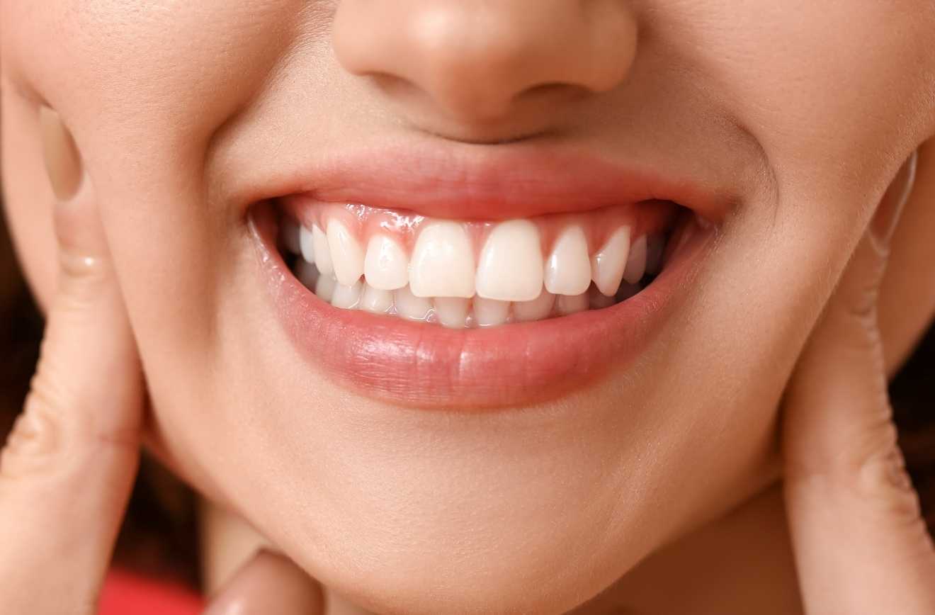 A Useful Guide You Need To See Before Gum Bleaching Treatment - Maltepe Dental Clinic